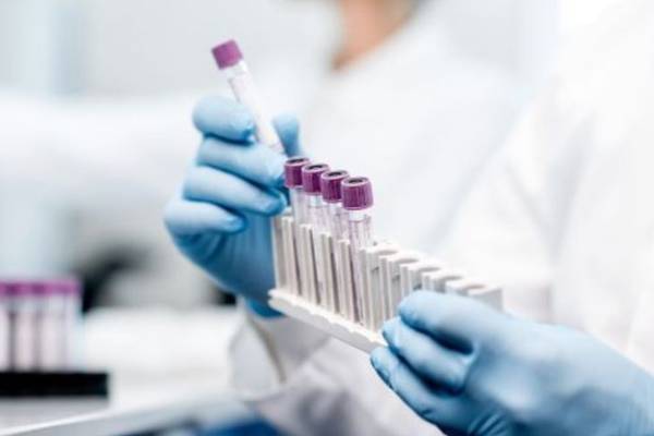 Coronavirus: Quest Diagnostics says it has cleared US Covid-19 test backlog