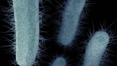 Assurances sought over superbug outbreak in Tallaght Hospital