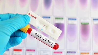 How the private sector answered Ireland’s call for help on coronavirus testing