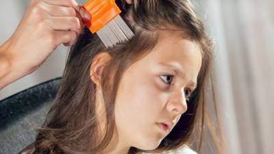Selfies and smartphones blamed for rise in head lice among schoolchildren