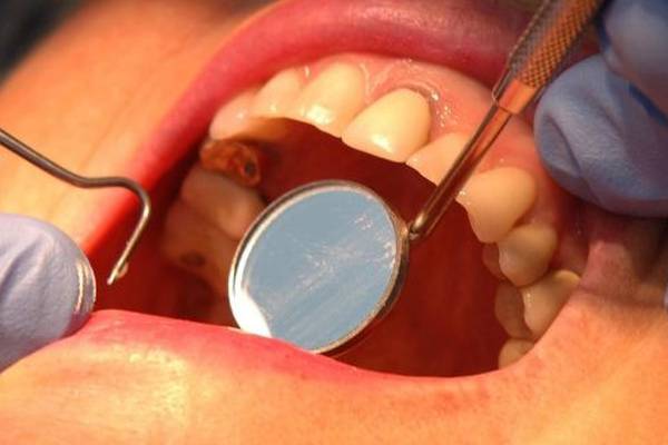 ‘Inconclusive’ inquiry into drain cleaner use in dental clinic criticised