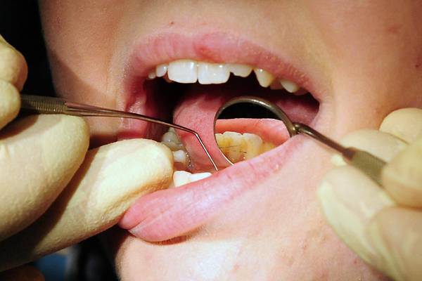 Oral microbiome becoming prime focus of research over links to disease beyond the mouth