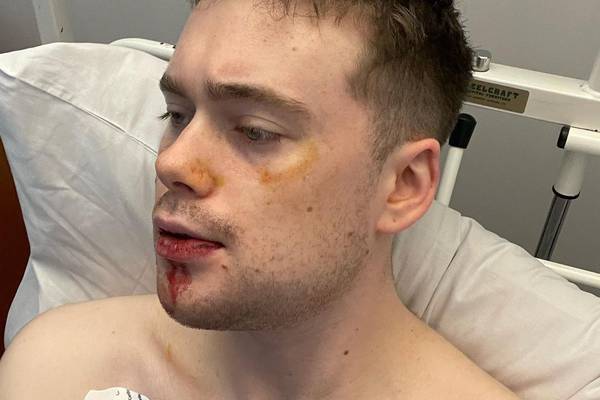 Dublin boardwalk attack: ‘Give me your passcode now or I’m going to stab you’