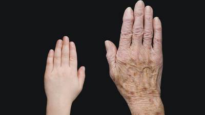 Juvenile idiopathic arthritis: the invisible disease 1,200 Irish children live with