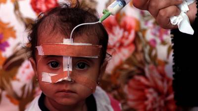 Yemen facing major famine as lack of funds forces aid cuts