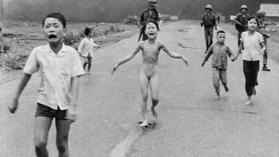 Vietnam war’s ‘napalm girl’ has laser treatment for wounds