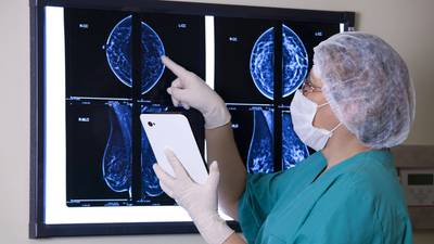 BreastCheck screening appointments delayed ‘by up to a year’