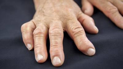 When it comes to arthritis treatment, timing is of the essence