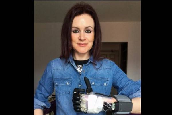 Mother hails €65,000 bionic  hand as life changing