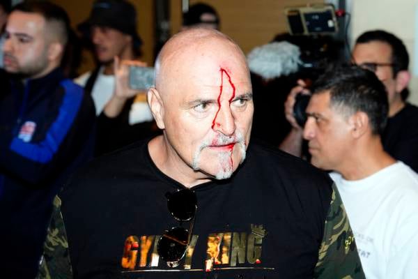 Tyson Fury’s father suffers cut to head as Oleksandr Usyk fight week begins