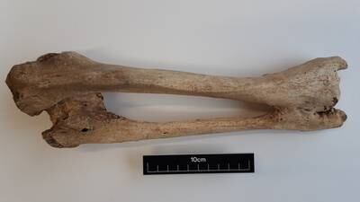 Genetic causes of bone tumours discovered in 1,000-year-old Irish skeletons 
