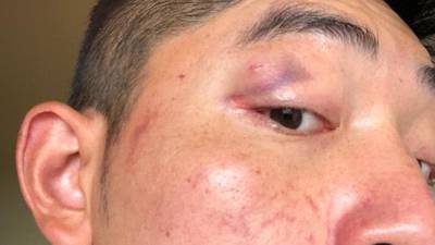 Gardaí investigate alleged racist attack on two Chinese men in Cork