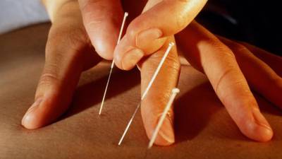 Understanding acupuncture through eastern and western medical traditions
