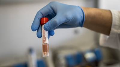 Coronavirus: Technopath offers employers not-for-profit antibody tests