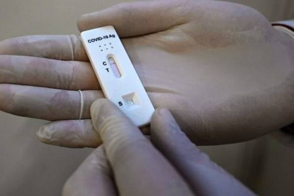 Coronavirus: 3,805 cases reported in State, with 582 in hospital