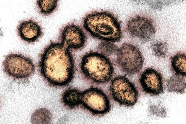 Coronavirus: Community transmission now main cause of Irish cases