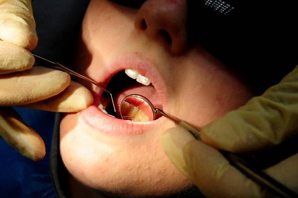 The Irish Times view on the new oral health policy: Filling the gaps