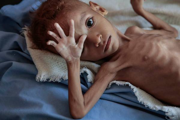 85,000 children may have died of hunger in Yemen, charity says