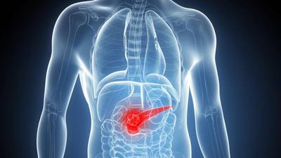 Ireland ranks fourth out of 30 countries for pancreatic cancer treatment