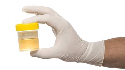 Drinking your own urine? There’s a Facebook group for that