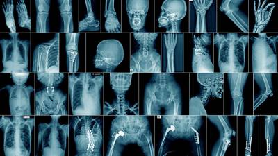 Are X-rays overused in Irish hospitals?
