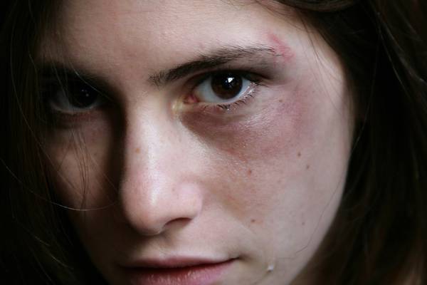 Study finds sharp rise in self-harm among teenage girls