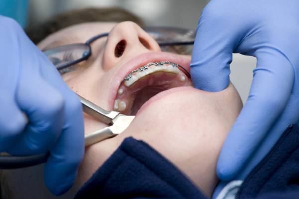 At least 50,000 children missing out on dental checks due to staff shortages
