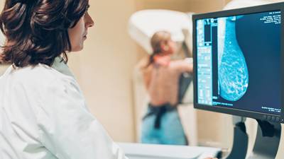 BreastCheck screenings fell by more than two-thirds in 2020