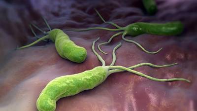 H. pylori: tackling the germ behind stomach ulcers and cancer