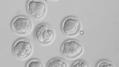 Stem cell research requires legislation and guidelines