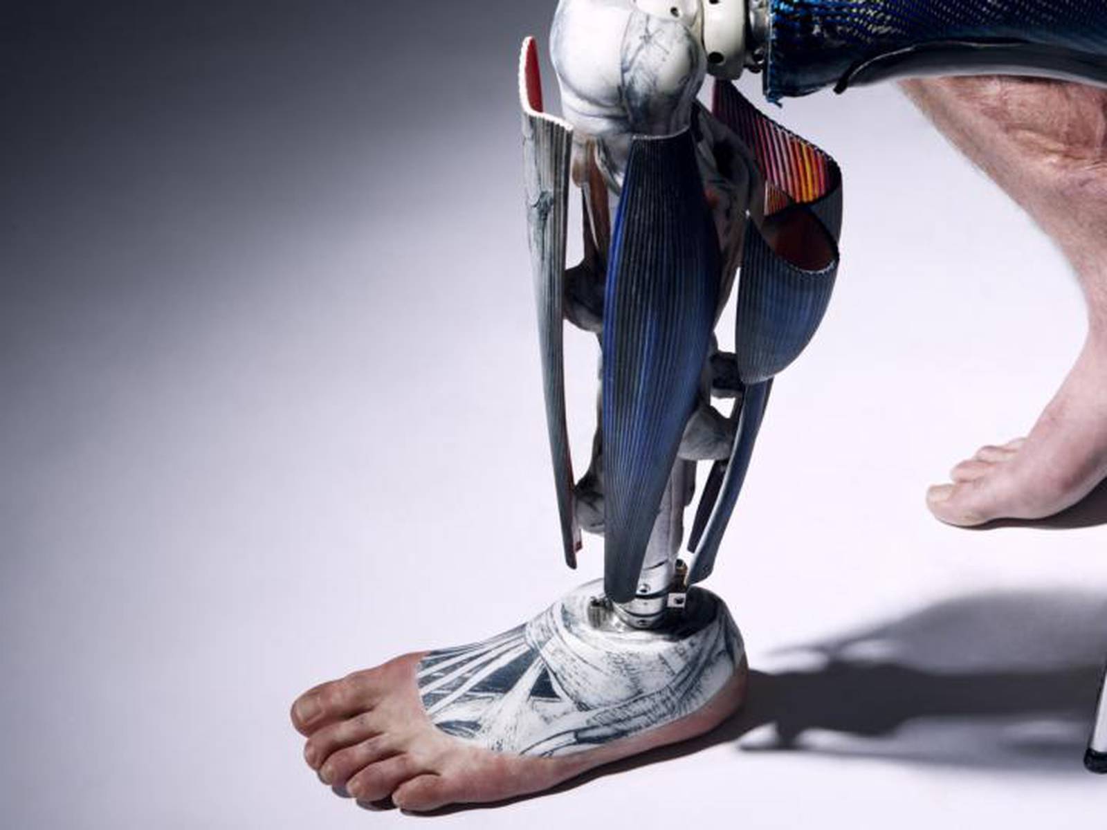 Stylish Prosthetic Limbs Boost Amputees' Quality of Life