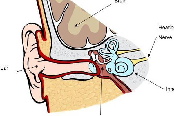 Irish-made tinnitus device cuts symptoms in 80% of patients