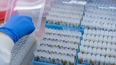 Supply of Covid vaccine doses held up by manufacturing delays