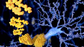 Alzheimer’s drug breakthrough slows cognitive decline - but with side-effects