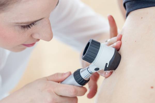 HSE approves new treatment for skin cancer patients