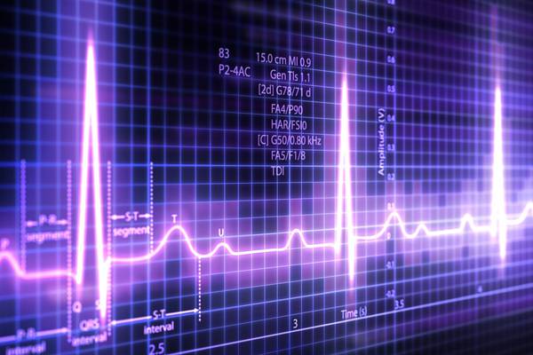 Medtch firm Fire1 raises €40m to develop remote heart monitor