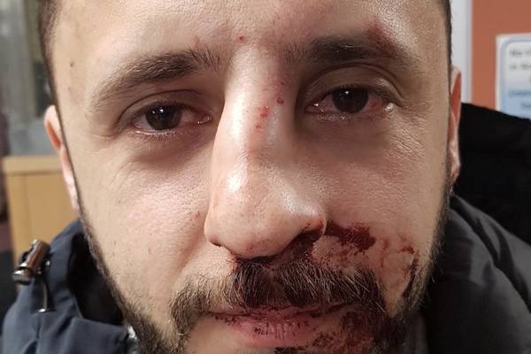 Street assaults: ‘I was walking, minding my own business and got punched from behind’
