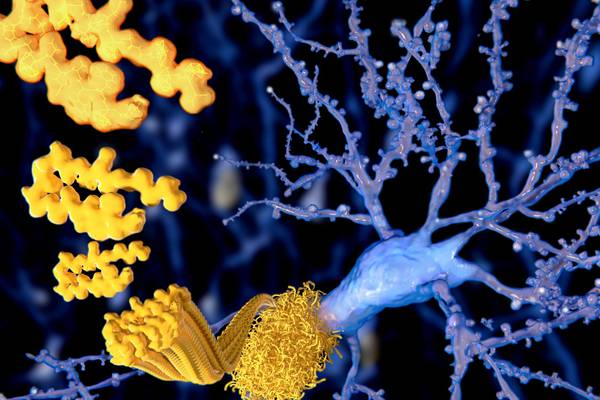 Alzheimer’s drug breakthrough slows cognitive decline - but with side-effects