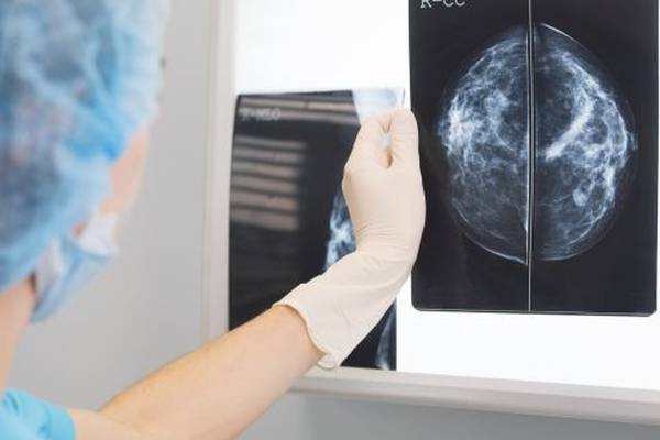 Wealthier people more likely to avail of cancer screening, says ESRI
