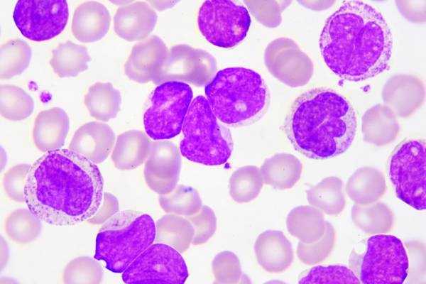 Very clean homes may trigger leukaemia in children - study