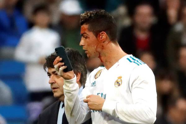 Zidane defends Ronaldo for using doctor’s phone to inspect face