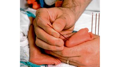 Fatal genetic condition added to list of conditions now tested in newborn babies using heel prick method