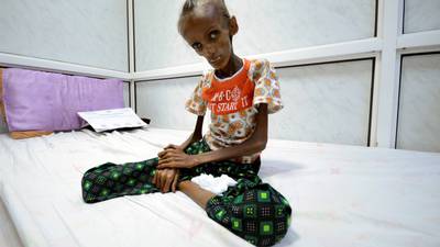 More than one million children starve as Yemen war rages
