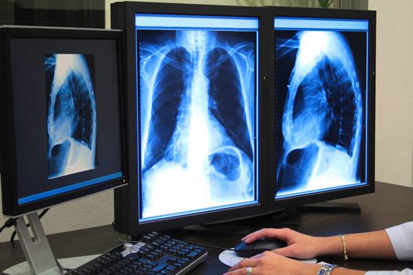 HSE imaging system fixed at ‘no cost’ to health service