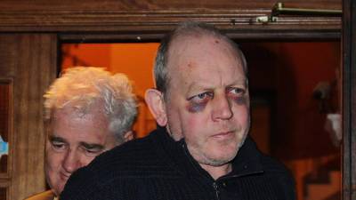 Pearse McCauley remanded again on assault charges