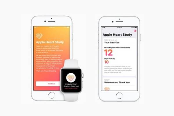 Study shows Apple Watch detects irregular heartbeat