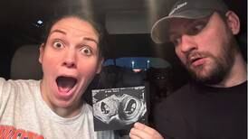 ‘Astounding’: Alabama woman with two uteruses is pregnant in both wombs