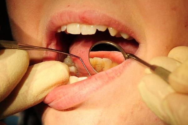 Dental treatment scheme ‘on brink of collapse’