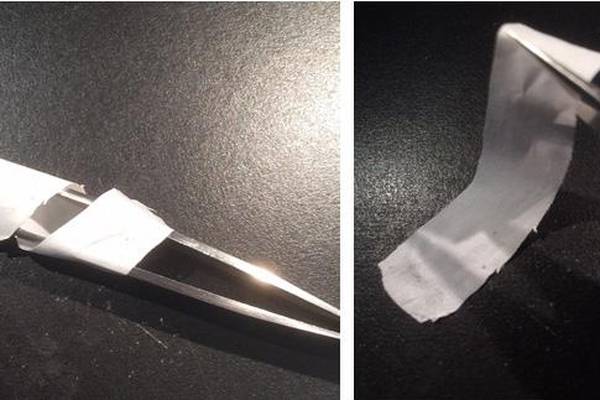 Implantable device that treats tendon damage developed by NUIG team