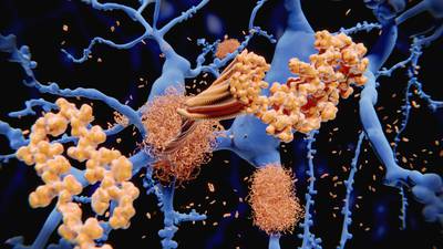 European regulators cast doubt on Biogen Alzheimer’s treatment